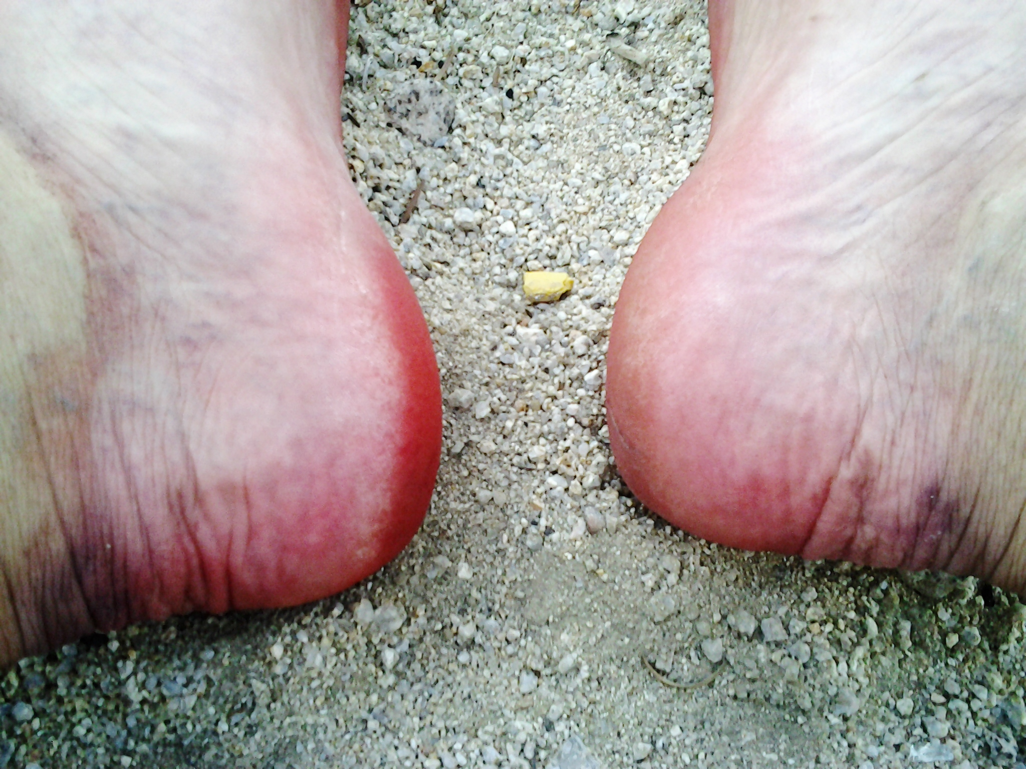 Axelle Red's Feet << wikiFeet